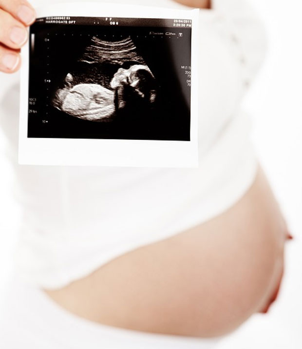 What You Need to Know About Pregnancy Ultrasound Scans A Mum Reviews