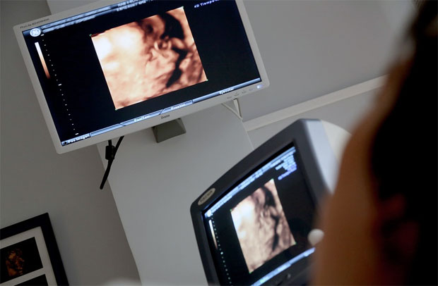 What You Need to Know About Pregnancy Ultrasound Scans A Mum Reviews