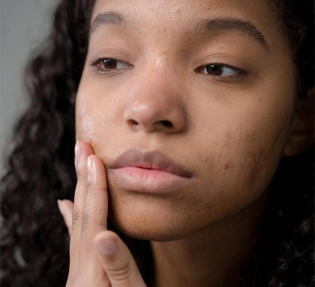 How to Use Zinc to Treat Acne
