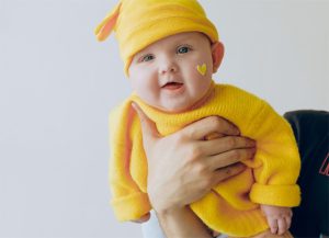 baby helmet therapy