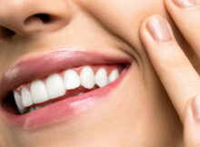 Everything You Need to Know About Veneers