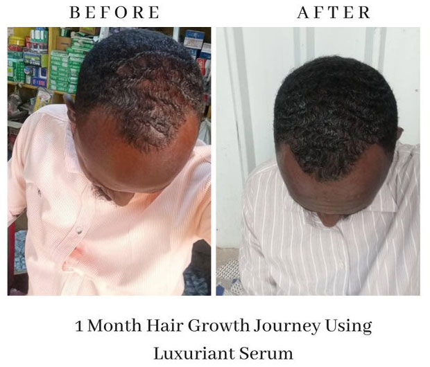 A Natural Solution to Hair Loss - Luxuriant Natural Hair Growth Products
