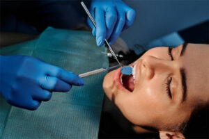 All About Dental Treatments in the UK