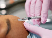 UK Consumers: Stay Safe from Counterfeit Botox with Expert Advice - What You Need to Know