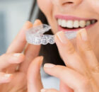 The Importance of Orthodontic Health and Choosing the Right Treatment