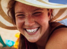 I Tried Teeth Whitening in Singapore—Here’s What Happened